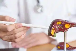 Les différents stades du cancer du foie